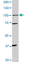 PR / Progesterone Receptor Antibody - PGR monoclonal antibody (M01), clone 3E11. Western blot of PGR expression in PC-12.