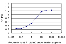 PR / Progesterone Receptor Antibody - Detection limit for recombinant GST tagged PGR is approximately 0.3 ng/ml as a capture antibody.