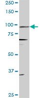 PR / Progesterone Receptor Antibody - PGR monoclonal antibody (M08), clone 4E9. Western blot of PGR expression in PC-12.