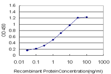 PR / Progesterone Receptor Antibody - Detection limit for recombinant GST tagged PGR is approximately 0.03 ng/ml as a capture antibody.