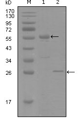 PR / Progesterone Receptor Antibody - Western blot using PGR mouse monoclonal antibody against truncated MBP-PGR recombinant protein (1) and truncated Trx-PGR(aa730-871) recombinant protein (2).