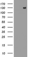 PR / Progesterone Receptor Antibody - HEK293T cells were transfected with the pCMV6-ENTRY control (Left lane) or pCMV6-ENTRY PGR (Right lane) cDNA for 48 hrs and lysed. Equivalent amounts of cell lysates (5 ug per lane) were separated by SDS-PAGE and immunoblotted with anti-PGR.