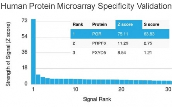 PR / Progesterone Receptor Antibody - Analysis of HuProt(TM) microarray containing more than 19,000 full-length human proteins using Progesterone Receptor antibody (clone PGR/2694). These results demonstrate the foremost specificity of the PGR/2694 mAb. Z- and S- score: The Z-score represents the strength of a signal that an antibody (in combination with a fluorescently-tagged anti-IgG secondary Ab) produces when binding to a particular protein on the HuProt(TM) array. Z-scores are described in units of standard deviations (SD's) above the mean value of all signals generated on that array. If the targets on the HuProt(TM) are arranged in descending order of the Z-score, the S-score is the difference (also in units of SD's) between the Z-scores. The S-score therefore represents the relative target specificity of an Ab to its intended target.