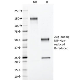PR / Progesterone Receptor Antibody - SDS-PAGE analysis of purified, BSA-free Progesterone Receptor antibody (clone PGR/2694) as confirmation of integrity and purity.