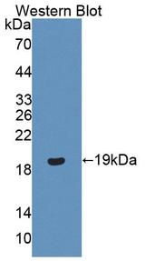 PR / Progesterone Receptor Antibody - Western Blot; Sample: Recombinant protein.