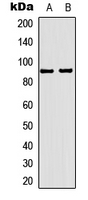 PR / Progesterone Receptor Antibody - Western blot analysis of Progesterone Receptor expression in HeLa (A); HUVEC (B) whole cell lysates.