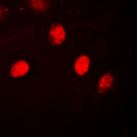 PR / Progesterone Receptor Antibody - Immunofluorescent analysis of Progesterone Receptor staining in HeLa cells. Formalin-fixed cells were permeabilized with 0.1% Triton X-100 in TBS for 5-10 minutes and blocked with 3% BSA-PBS for 30 minutes at room temperature. Cells were probed with the primary antibody in 3% BSA-PBS and incubated overnight at 4 deg C in a humidified chamber. Cells were washed with PBST and incubated with a DyLight 594-conjugated secondary antibody (red) in PBS at room temperature in the dark. DAPI was used to stain the cell nuclei (blue).