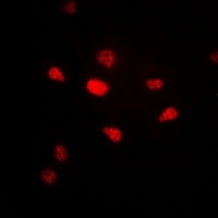 PR / Progesterone Receptor Antibody - Immunofluorescent analysis of Progesterone Receptor staining in A549 cells. Formalin-fixed cells were permeabilized with 0.1% Triton X-100 in TBS for 5-10 minutes and blocked with 3% BSA-PBS for 30 minutes at room temperature. Cells were probed with the primary antibody in 3% BSA-PBS and incubated overnight at 4 deg C in a humidified chamber. Cells were washed with PBST and incubated with a DyLight 594-conjugated secondary antibody (red) in PBS at room temperature in the dark. DAPI was used to stain the cell nuclei (blue).