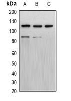 PR / Progesterone Receptor Antibody - Western blot analysis of Progesterone Receptor expression in Jurkat (A); HeLa (B); COS7 (C) whole cell lysates.