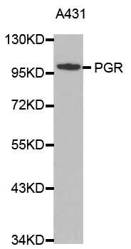 PR / Progesterone Receptor Antibody - Western blot analysis of extracts of A431 cell lines.