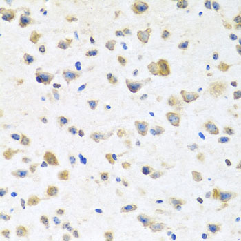 PR / Progesterone Receptor Antibody - Immunohistochemistry of paraffin-embedded mouse brain tissue.