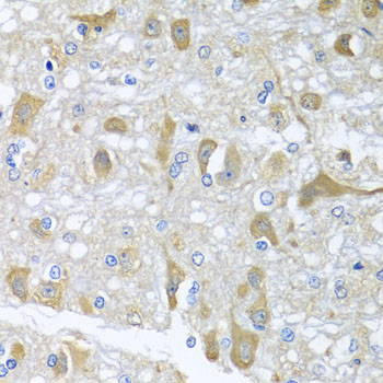 PR / Progesterone Receptor Antibody - Immunohistochemistry of paraffin-embedded rat brain tissue.