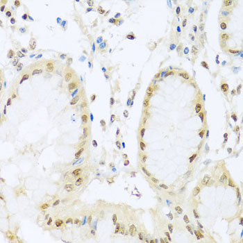 PR / Progesterone Receptor Antibody - Immunohistochemistry of paraffin-embedded human stomach tissue.