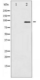 PR / Progesterone Receptor Antibody - Western blot of Progesterone Receptor expression in HeLa whole cell lysates,The lane on the left is treated with the antigen-specific peptide.
