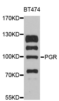 PR / Progesterone Receptor Antibody - Western blot analysis of extracts of BT-474 cells, using PGR antibody at 1:3000 dilution. The secondary antibody used was an HRP Goat Anti-Rabbit IgG (H+L) at 1:10000 dilution. Lysates were loaded 25ug per lane and 3% nonfat dry milk in TBST was used for blocking. An ECL Kit was used for detection and the exposure time was 90s.