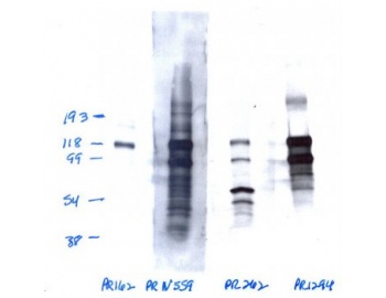 PR / Progesterone Receptor Antibody - Western blot of  Progesterone Receptor Antibody [1064/E2] (1st column) at a concentration of 10 ug/ml on 50 ug of T47D nuclear extract.  PR Mab 1294 (1 ug/ml) as a positive control 