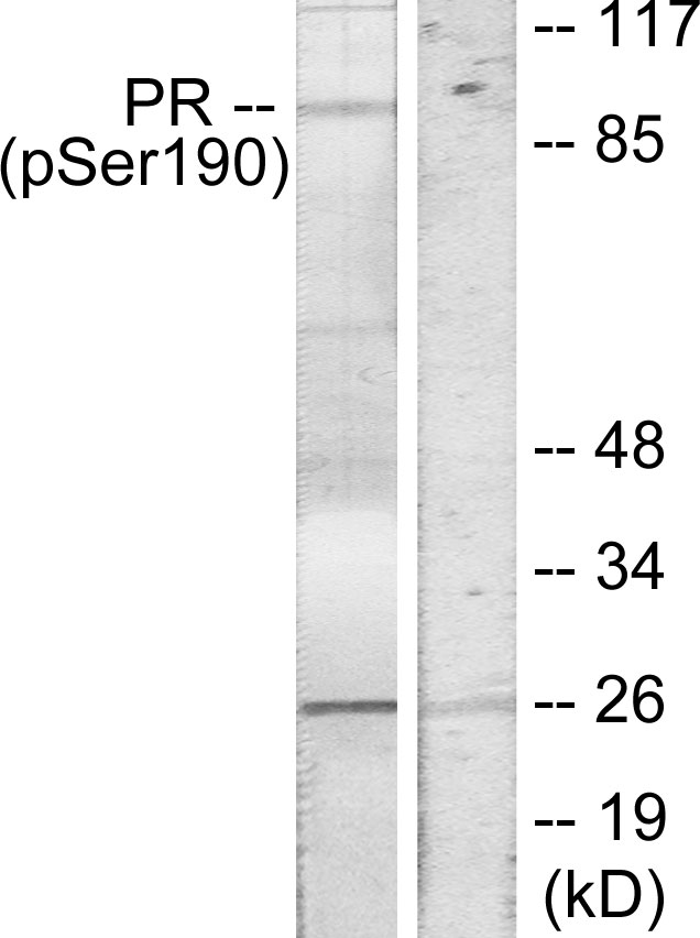 PR / Progesterone Receptor Antibody - Western blot analysis of lysates from COS7 cells treated with EGF, using Progesterone Receptor (Phospho-Ser190) Antibody. The lane on the right is blocked with the phospho peptide.