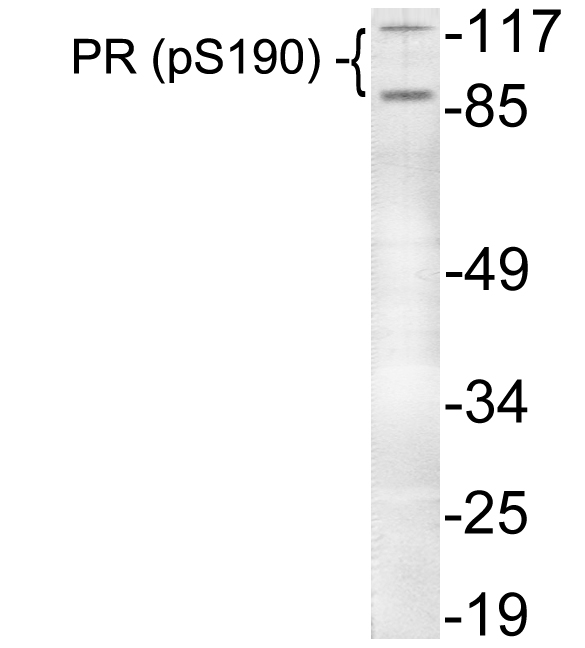 PR / Progesterone Receptor Antibody - Western blot of p-Progesterone Receptor (S190) pAb in extracts from HeLa cells.