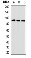 PR / Progesterone Receptor Antibody - Western blot analysis of Progesterone Receptor (pS190) expression in HEK293T (A); HeLa EGF-treated (B); HUVEC EGF-treated (C) whole cell lysates.