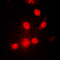 PR / Progesterone Receptor Antibody - Immunofluorescent analysis of Progesterone Receptor (pS190) staining in MCF7 cells. Formalin-fixed cells were permeabilized with 0.1% Triton X-100 in TBS for 5-10 minutes and blocked with 3% BSA-PBS for 30 minutes at room temperature. Cells were probed with the primary antibody in 3% BSA-PBS and incubated overnight at 4 deg C in a humidified chamber. Cells were washed with PBST and incubated with a DyLight 594-conjugated secondary antibody (red) in PBS at room temperature in the dark. DAPI was used to stain the cell nuclei (blue).