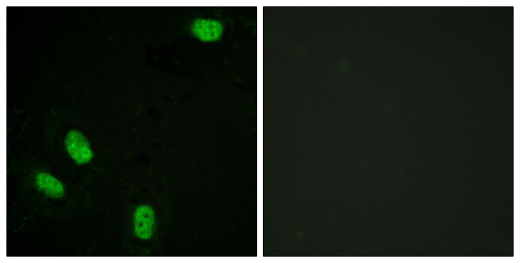PR / Progesterone Receptor Antibody - Immunofluorescence analysis of HeLa cells, using Progesterone Receptor (Phospho-Ser294) Antibody. The picture on the right is blocked with the phospho peptide.