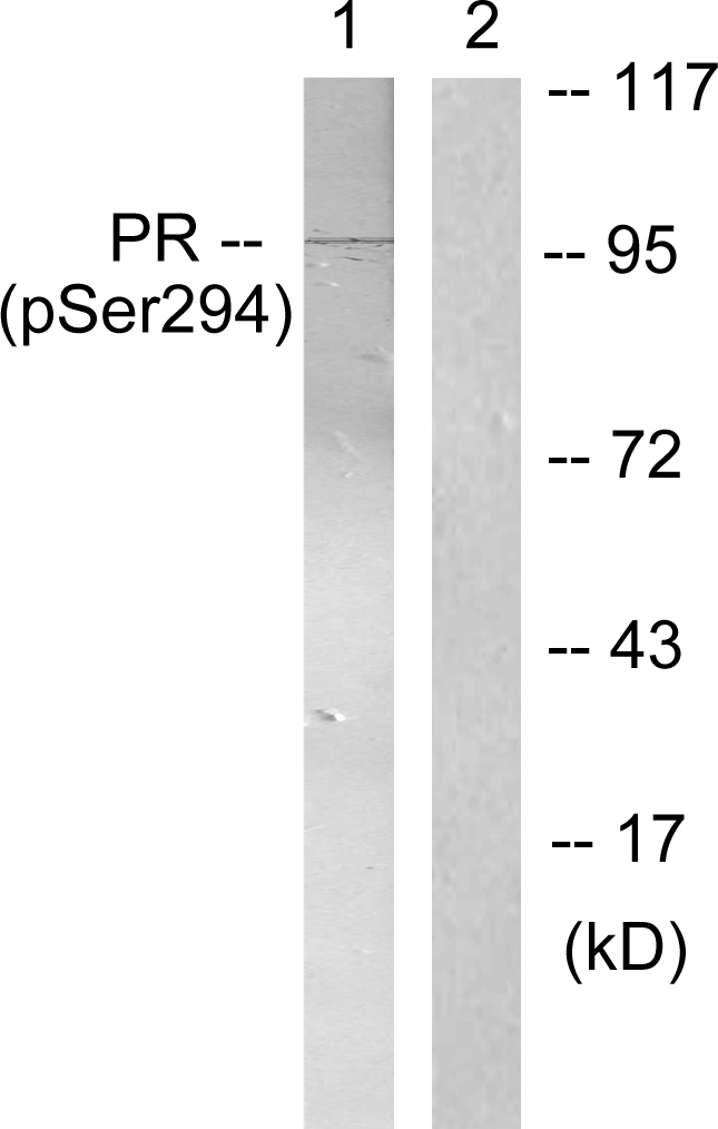 PR / Progesterone Receptor Antibody - Western blot analysis of lysates from 293 cells treated with Etoposide 25uM 60', using Progesterone Receptor (Phospho-Ser294) Antibody. The lane on the right is blocked with the phospho peptide.