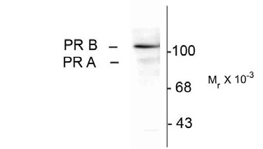 PR / Progesterone Receptor Antibody - Western blot of whole cell T47D lysate prepared from cells that had been incubated in the presence of the synthetic progestin agonist R5020 (500 nM) showing specific immunolabeling of the -90k PR-A isoform and the -120 PR-13 isoform of the progesterone re.