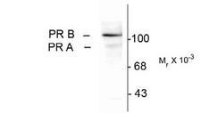 PR / Progesterone Receptor Antibody - Western blot of whole cell T47D lysate prepared from cells that had been incubated in the presence of the synthetic progestin agonist R5020 (500 nM) showing specific immunolabeling of the -90k PR-A isoform and the -120 PR-13 isoform of the progesterone re.