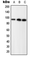 PR / Progesterone Receptor Antibody - Western blot analysis of Progesterone Receptor (pS294) expression in HEK293T EGF-treated (A); SP2/0 EGF-treated (B); PC12 PMA-treated (C) whole cell lysates.