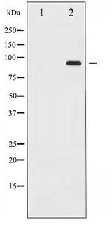 PR / Progesterone Receptor Antibody - Western blot of Progesterone Receptor phosphorylation expression in Etoposide treated 293 whole cell lysates,The lane on the left is treated with the antigen-specific peptide.