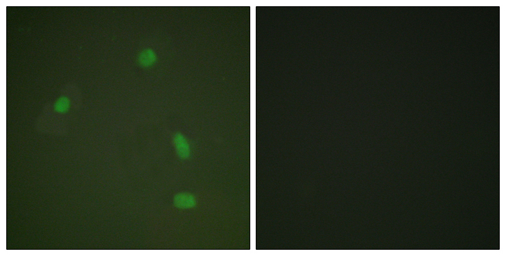 PR / Progesterone Receptor Antibody - Immunofluorescence analysis of A549 cells, using Progesterone Receptor (Phospho-Ser400) Antibody. The picture on the right is blocked with the phospho peptide.