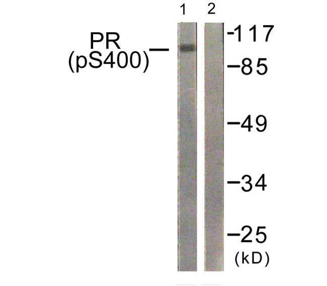 PR / Progesterone Receptor Antibody - Western blot analysis of lysates from 293 cells treated with heat shock, using Progesterone Receptor (Phospho-Ser400) Antibody. The lane on the right is blocked with the phospho peptide.