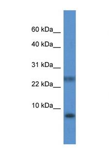 PRAC1 / PRAC Antibody - PRAC antibody Western blot of Fetal Liver lysate. Antibody concentration 1 ug/ml.  This image was taken for the unconjugated form of this product. Other forms have not been tested.