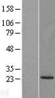 PRADC1 Protein - Western validation with an anti-DDK antibody * L: Control HEK293 lysate R: Over-expression lysate