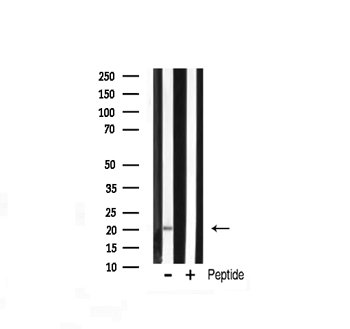 PRAF2 Antibody - Western blot analysis of JM4 expression in rat liver tissue lysate