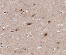 PRAF2 Antibody - 1:200 staining human brain tissue by IHC-P. The tissue was formaldehyde fixed and a heat mediated antigen retrieval step in citrate buffer was performed. The tissue was then blocked and incubated with the antibody for 1.5 hours at 22°C. An HRP conjugated goat anti-rabbit antibody was used as the secondary.