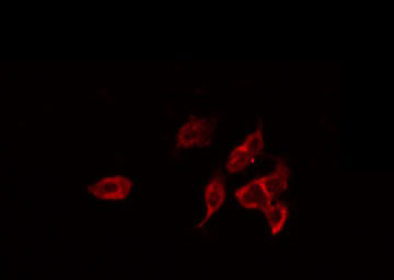PRAF2 Antibody - Staining LOVO cells by IF/ICC. The samples were fixed with PFA and permeabilized in 0.1% Triton X-100, then blocked in 10% serum for 45 min at 25°C. The primary antibody was diluted at 1:200 and incubated with the sample for 1 hour at 37°C. An Alexa Fluor 594 conjugated goat anti-rabbit IgG (H+L) Ab, diluted at 1/600, was used as the secondary antibody.