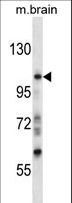 PRAGMIN / SGK223 Antibody - Mouse Sgk223 Antibody western blot of mouse brain tissue lysates (35 ug/lane). The Sgk223 antibody detected the Sgk223 protein (arrow).