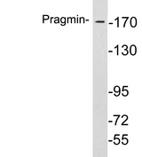 PRAGMIN / SGK223 Antibody - Western blot analysis of lysates from COLO205 cells, using Pragmin antibody.