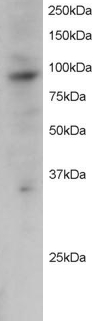 PRAM1 Antibody - Antibody staining (2 ug/ml) of Jurkat lysate (RIPA buffer, 30 ug total protein per lane). Primary incubated for 12 hour. Detected by Western blot of chemiluminescence.