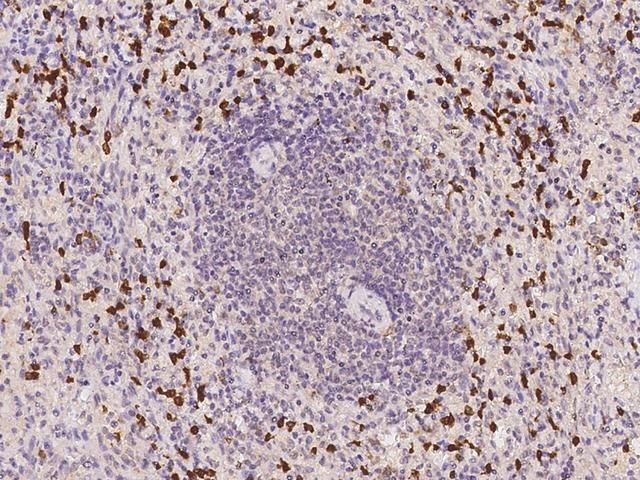 PRAM1 Antibody - Immunochemical staining of human PRAM1 in human spleen with rabbit polyclonal antibody at 1:300 dilution, formalin-fixed paraffin embedded sections.