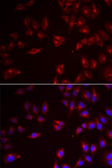 PRAME Antibody - Immunofluorescence analysis of U2OS cells.