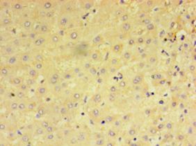 PRAME Antibody - Immunohistochemistry of paraffin-embedded human liver tissue using antibody at 1:100 dilution.  This image was taken for the unconjugated form of this product. Other forms have not been tested.