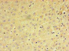 PRAME Antibody - Immunohistochemistry of paraffin-embedded human liver tissue using antibody at 1:100 dilution.  This image was taken for the unconjugated form of this product. Other forms have not been tested.