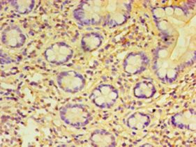 PRAME Antibody - Immunohistochemistry of paraffin-embedded human small intestine tissue using antibody at 1:100 dilution.  This image was taken for the unconjugated form of this product. Other forms have not been tested.