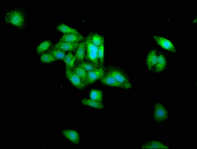 PRAME Antibody - Immunofluorescence staining of HepG2 cells with PRAME Antibody at 1:266, counter-stained with DAPI. The cells were fixed in 4% formaldehyde, permeabilized using 0.2% Triton X-100 and blocked in 10% normal Goat Serum. The cells were then incubated with the antibody overnight at 4°C. The secondary antibody was Alexa Fluor 488-congugated AffiniPure Goat Anti-Rabbit IgG(H+L).