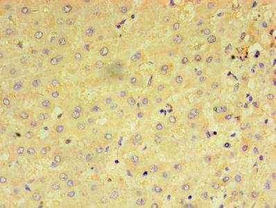 PRAME Antibody - Immunohistochemistry of paraffin-embedded human liver tissue using PRAME Antibody at dilution of 1:100