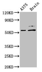 PRAME Antibody - Western Blot Positive WB detected in: A375 whole cell lysate, Mouse brain tissue All lanes: PRAME antibody at 4µg/ml Secondary Goat polyclonal to rabbit IgG at 1/50000 dilution Predicted band size: 58 kDa Observed band size: 58 kDa