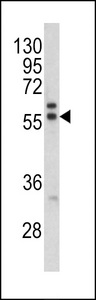 PRAME Antibody - Western blot of MAPE antibody in K562 cell line lysates (35 ug/lane). MAPE (arrow) was detected using the purified antibody.