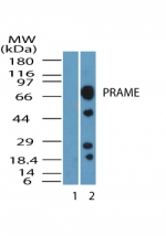 PRAME Antibody - Western blot of PRAME in MCF7 cell lysate. Lane 1 shows pre-immune sera. Lane 2 shows antibody tested at 1:5000 dilution.